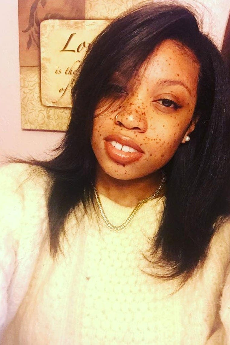 15 freckles black women