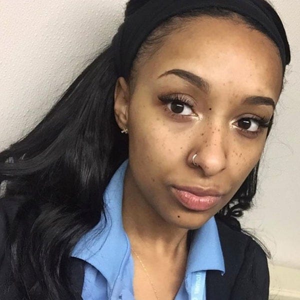 07 freckles black women