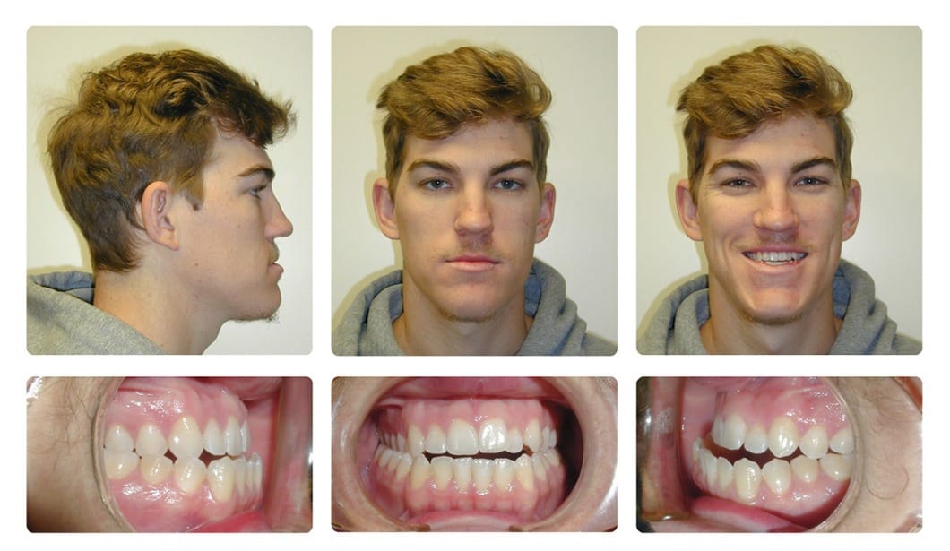 Patient 14 before