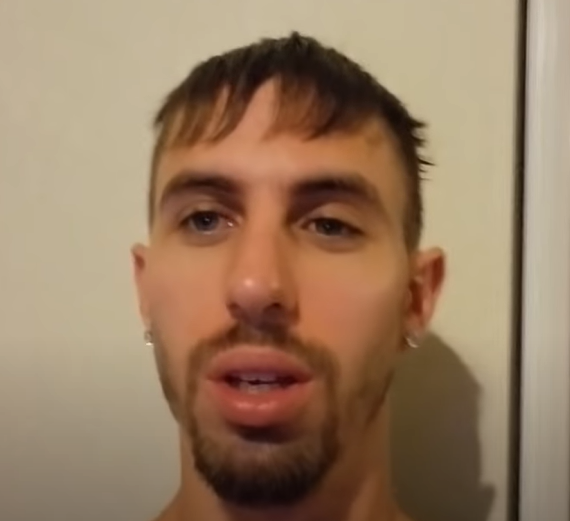 Filthy rat face