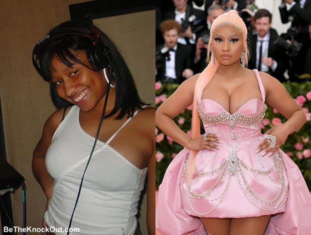 Nicki minaj boob job