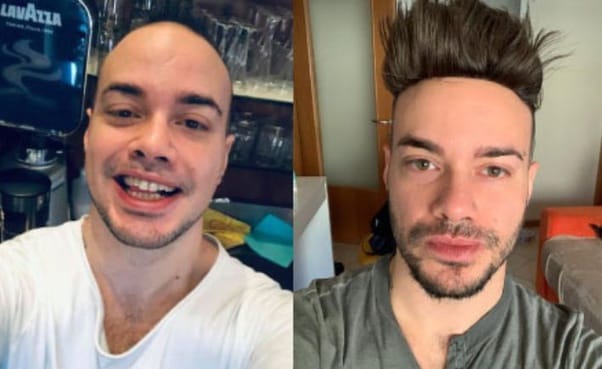 Hair system