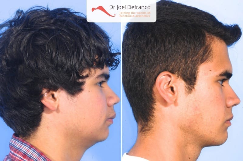 Dr Joel Defrancq 1457274102046258400 2015 1