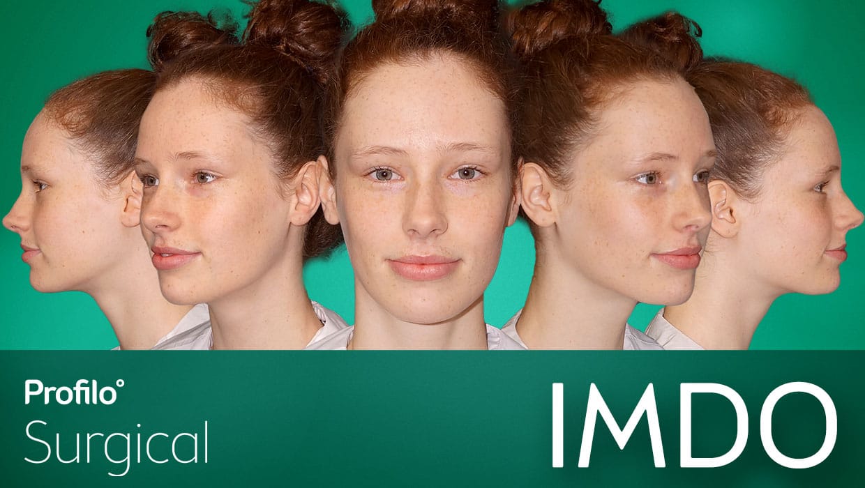 Imdo small lower jaw 2