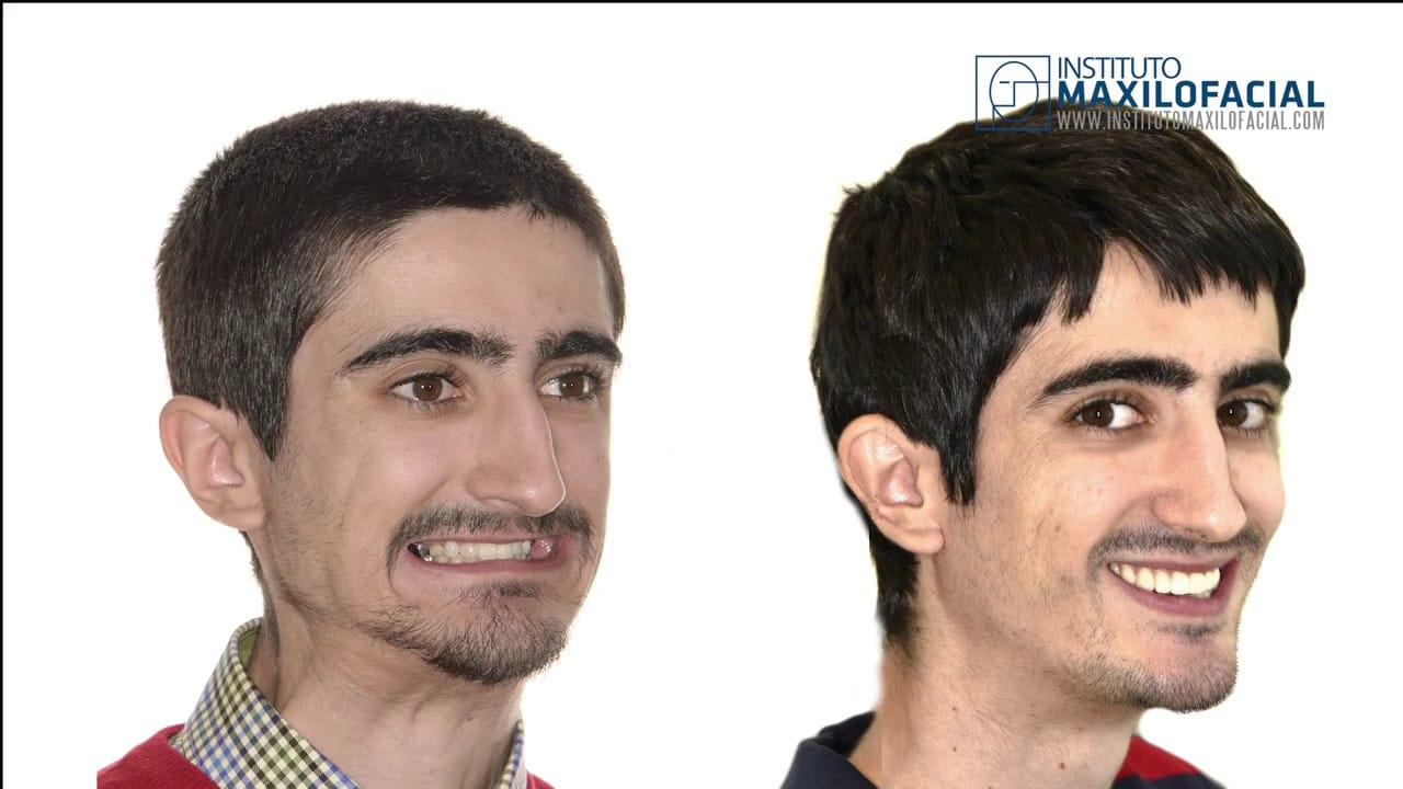 Maxresdefault 17