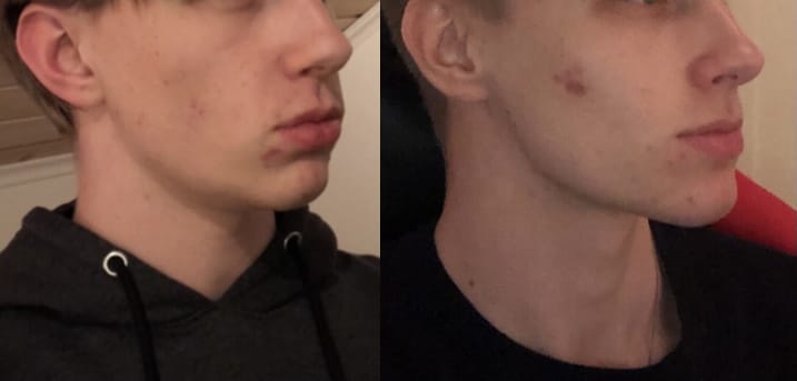 CEECA247 D992 48C8 A268 81A5FFAA37AB