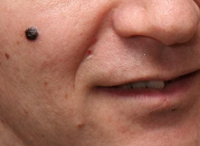 Mole