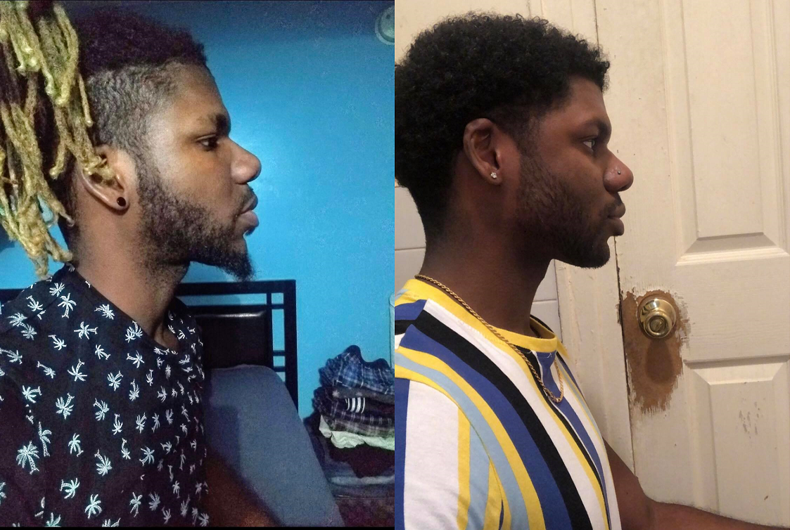 Before after
