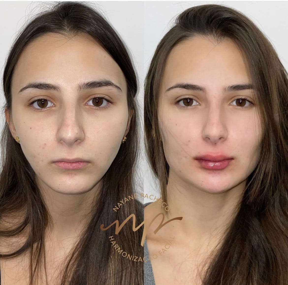 F9683360 4495 4F21 95BB C3E316CDADB2