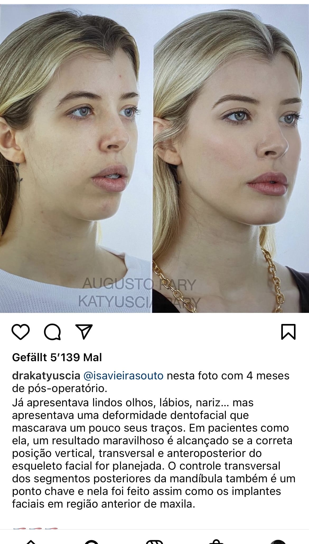 23B82E80 DFB5 4D55 AADE 60F5FE0A5FFA
