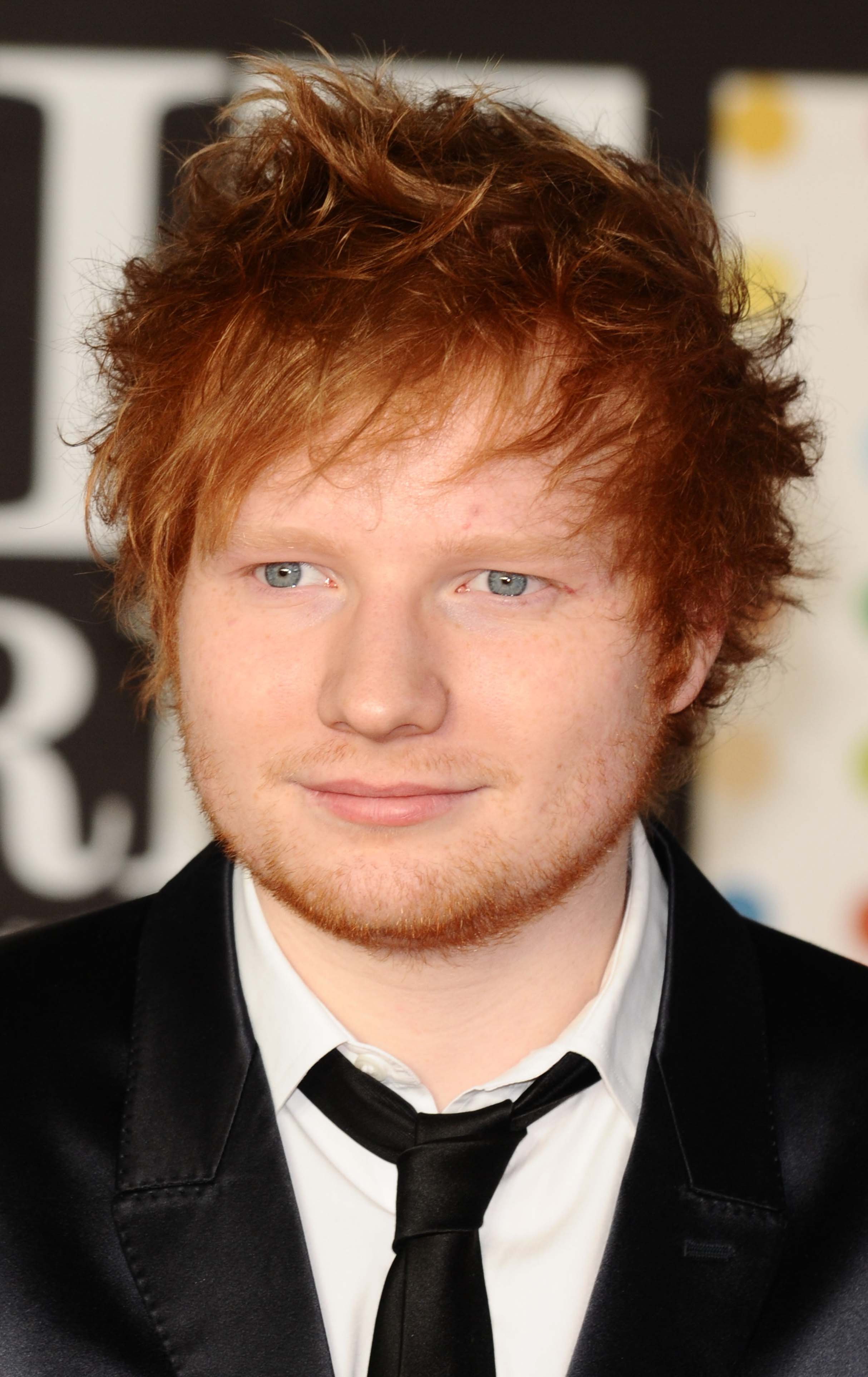 Ed Sheerans Messy Cowlick 