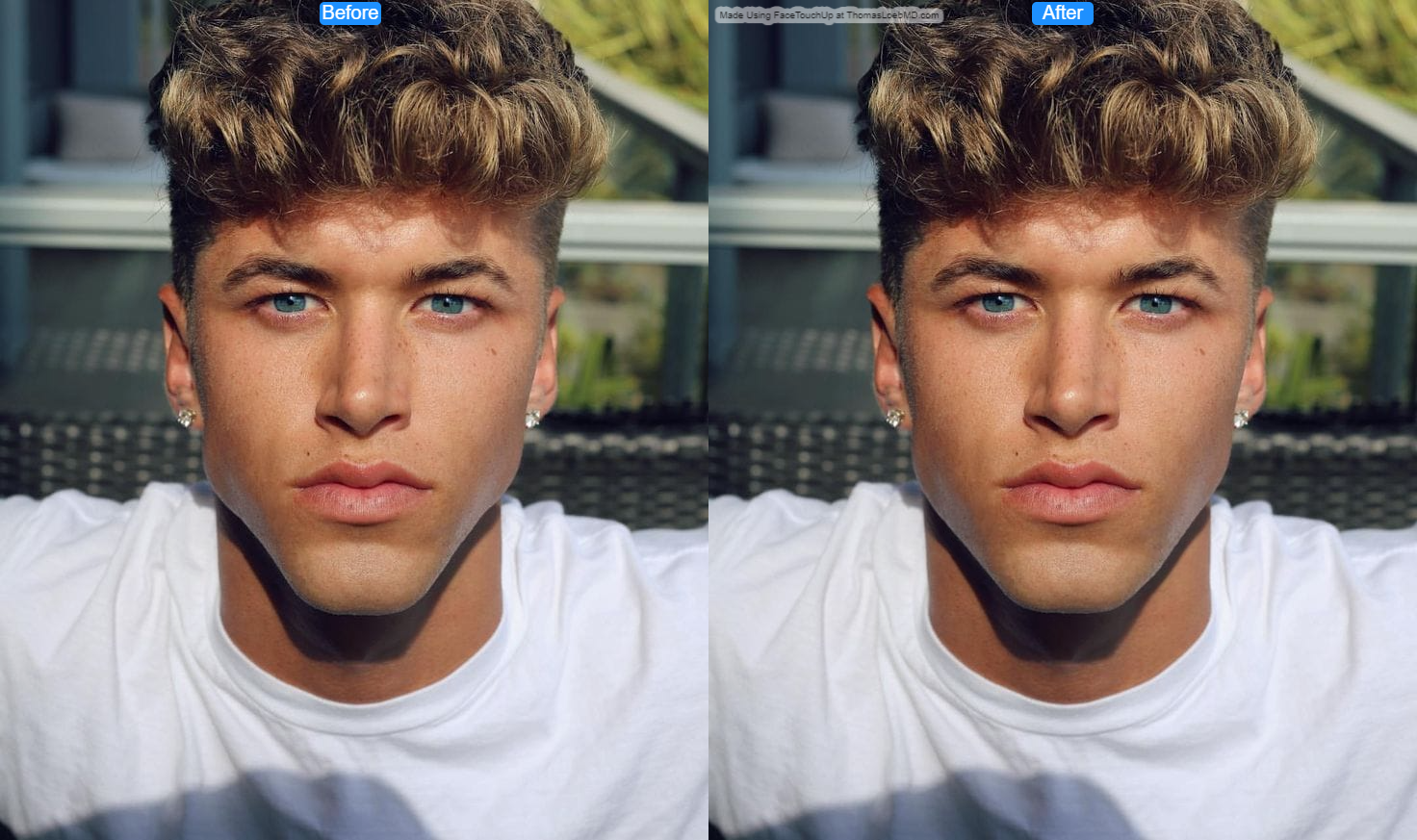 Bicycle jaw before after