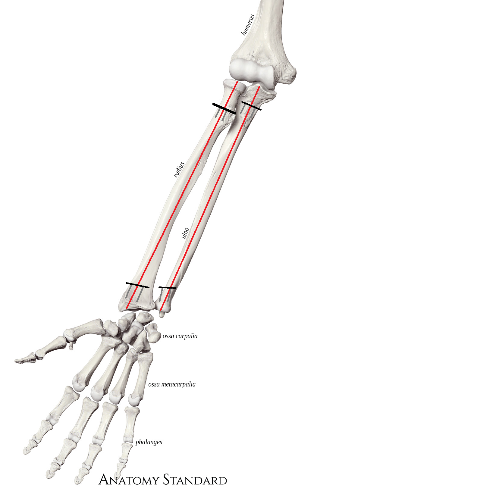 Chad wrists