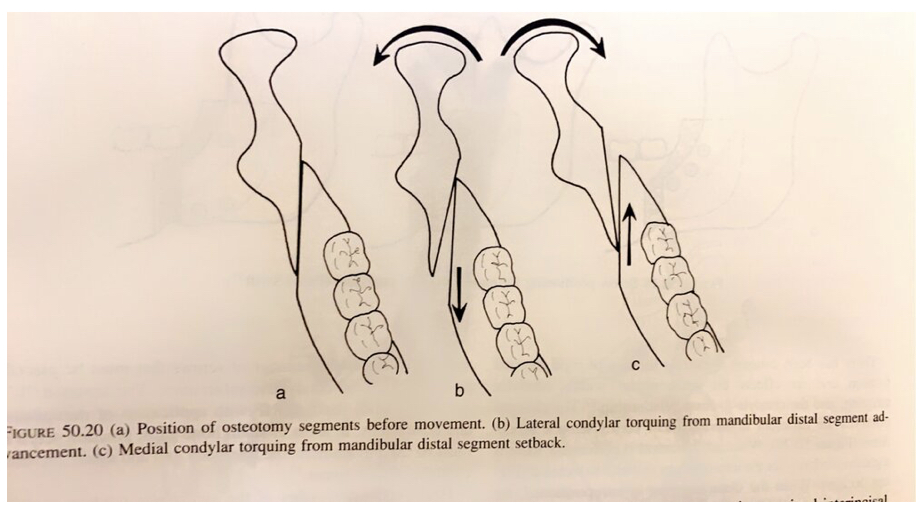 B0573164 FFFC 4660 906F D2D604BB8826