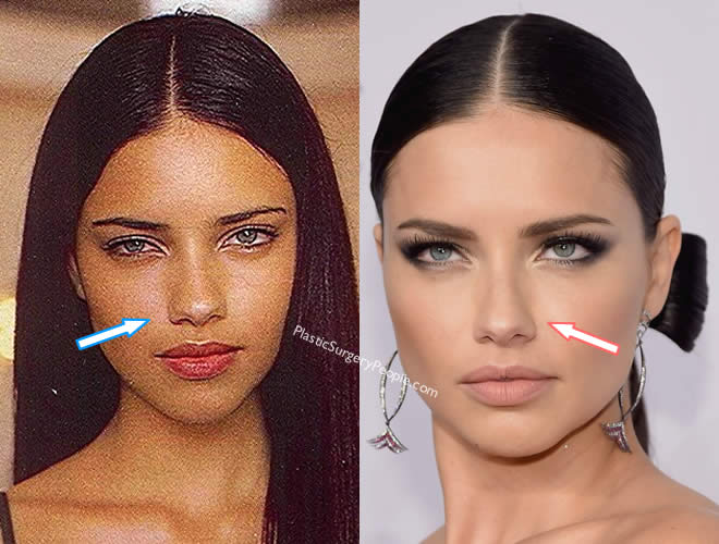 Adriana lima nose job