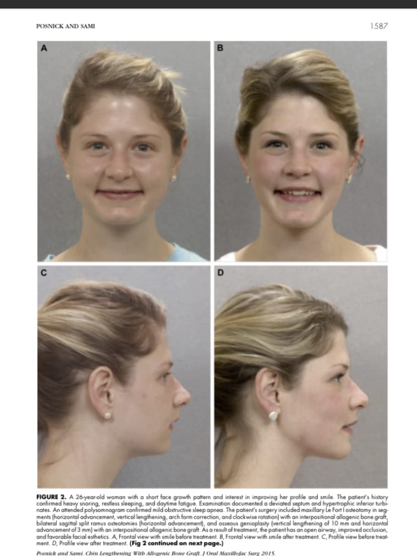 C8B3A029 2CB2 4F16 A029 0529A5BED543