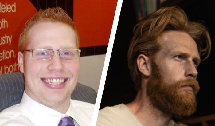 Before after beard jawline