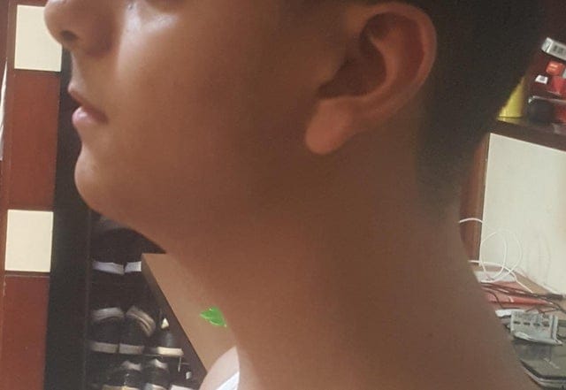 Side profile 13