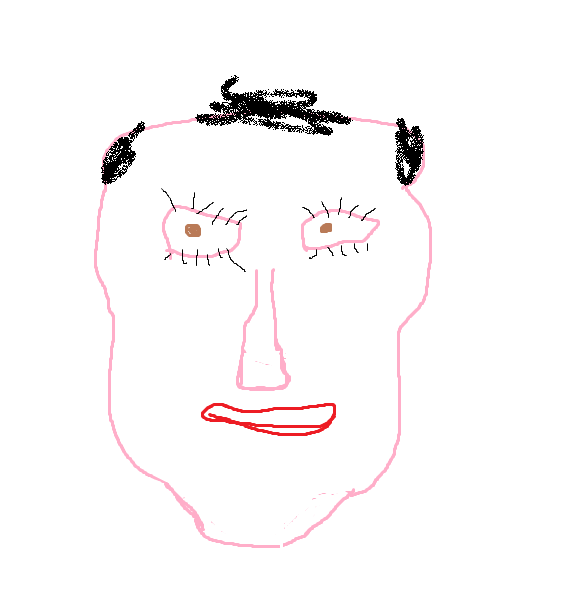 Baldman