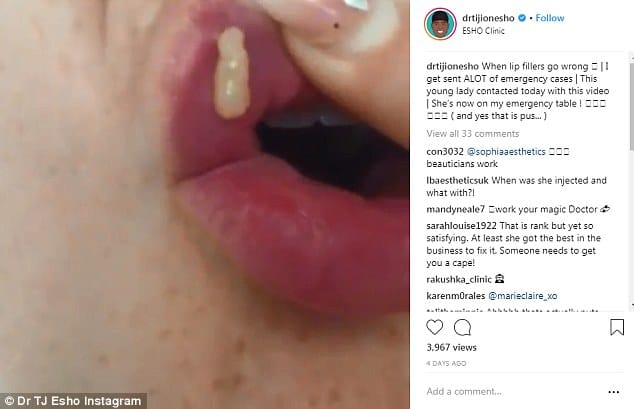 4E8D992E00000578 5989933 A shocking video showing pus leaking from a woman s lips has dem m 49