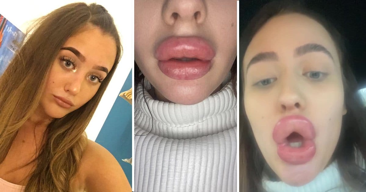 Olivia mccann lips