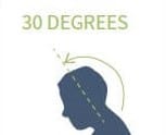 Head forward posture 