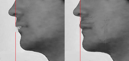 Beforeafter