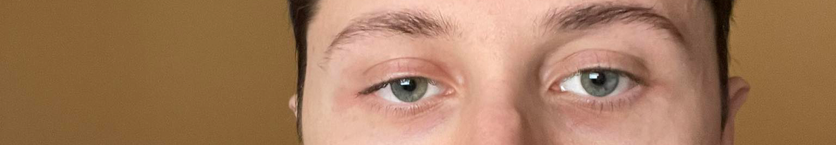 Eyearea8 Eyearea8