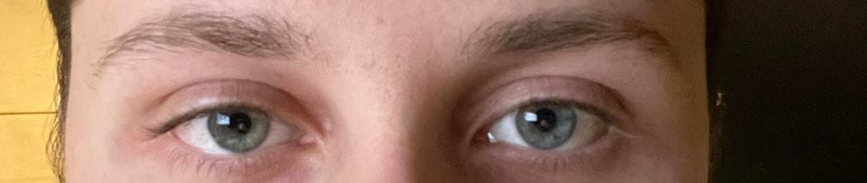 Eyearea9 Eyearea9