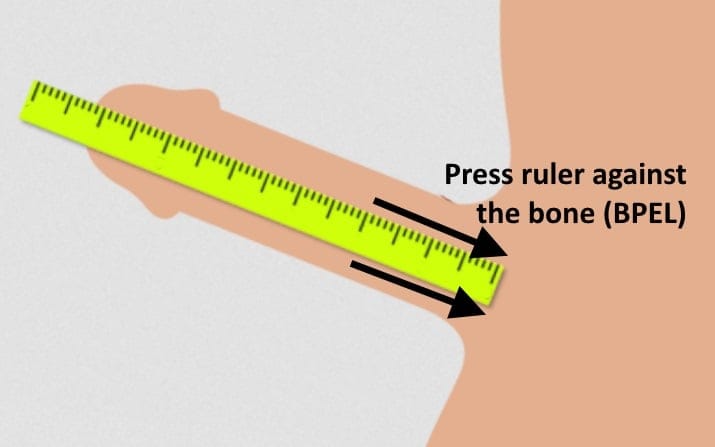 BPEL ruler measurement