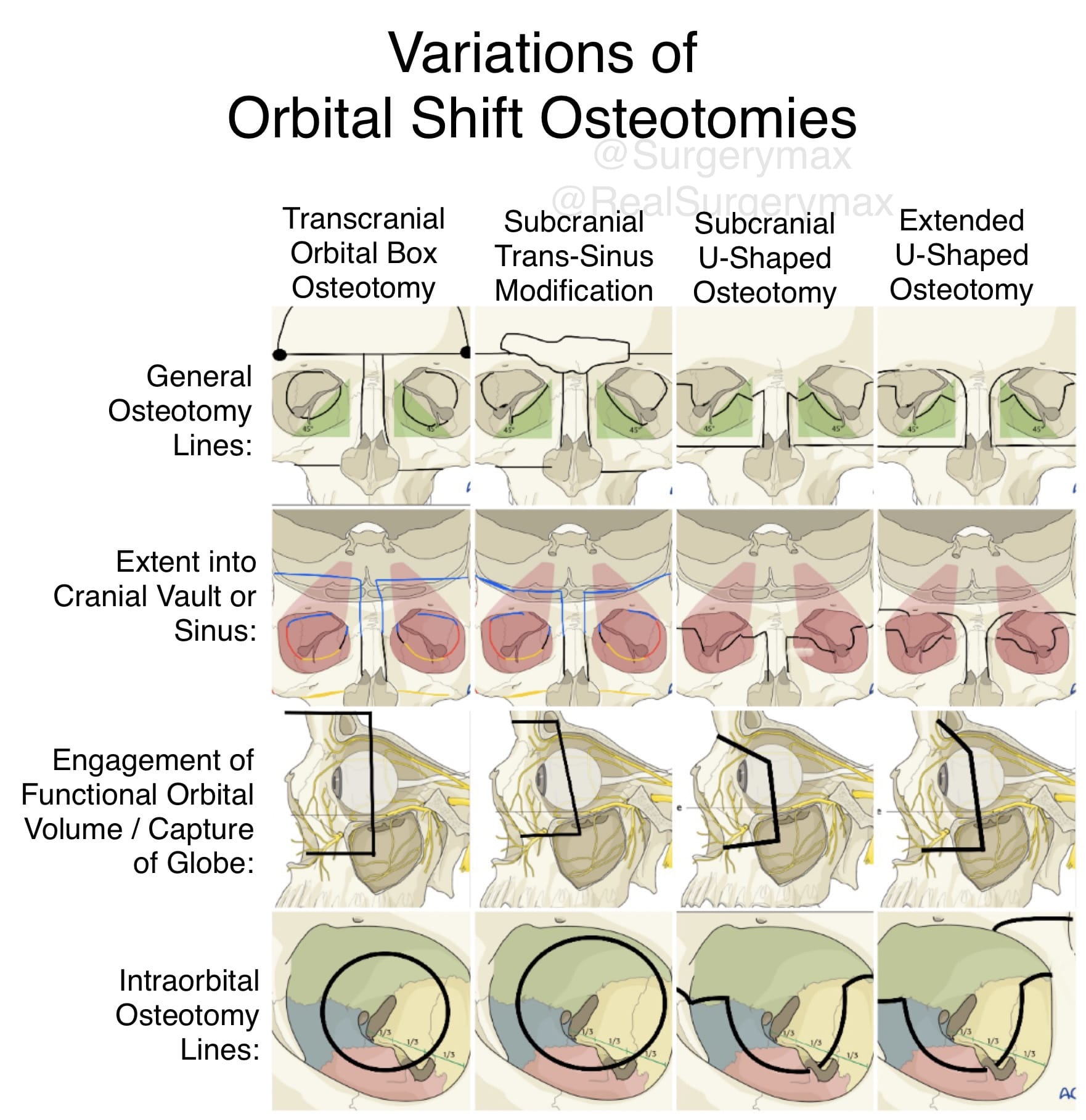 B1467F4C 75CE 4640 9FC2 C50058778341