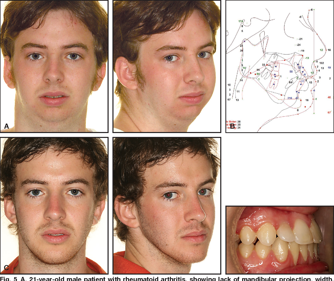 D35E4184 B615 423B A81B 700771F973A1