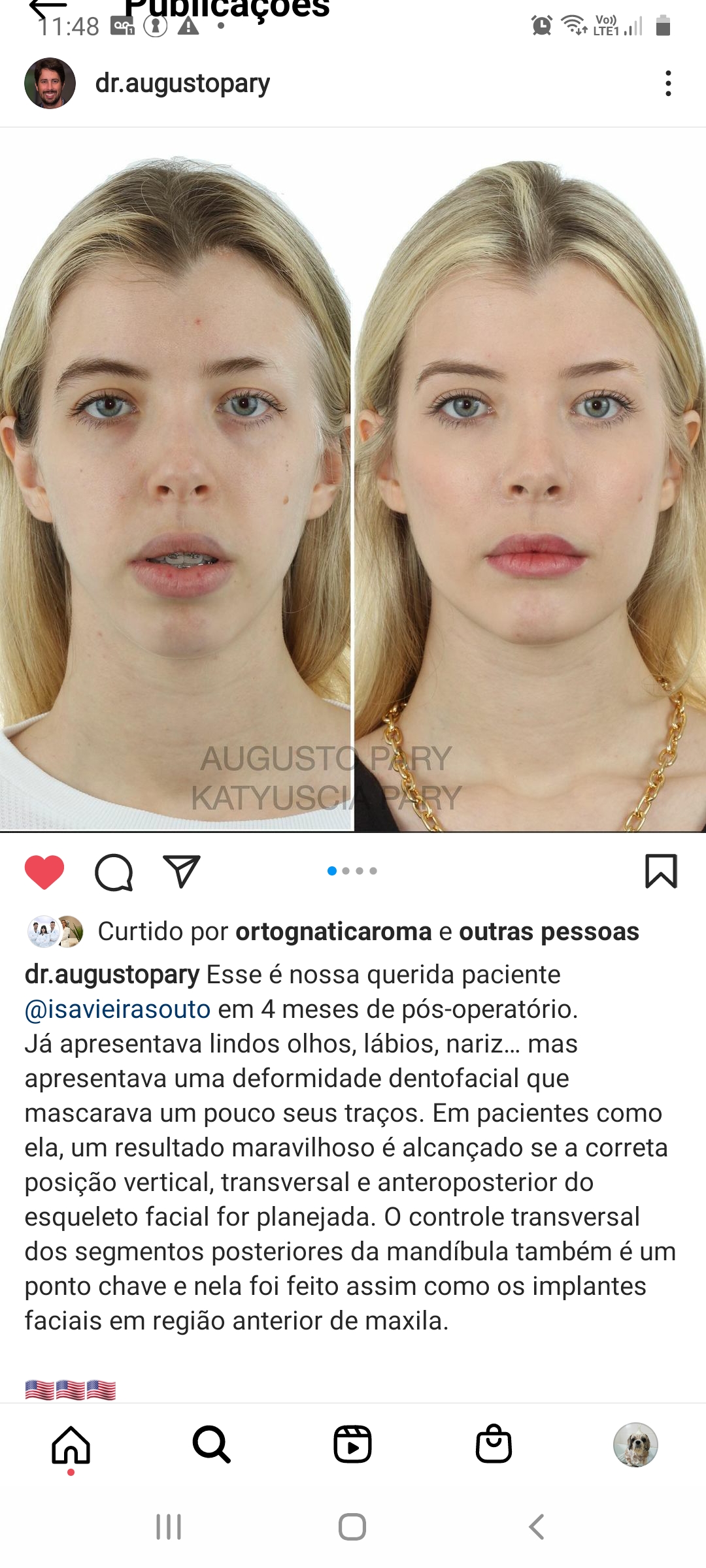 Screenshot 20211124 114841 Instagram