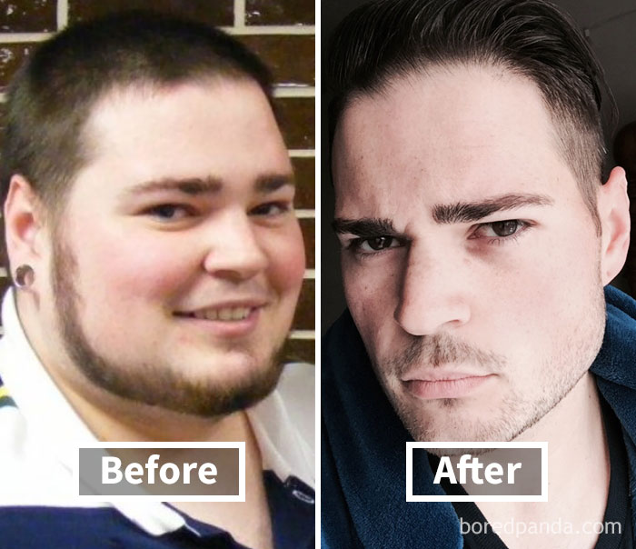Before after weight loss face transformation 91 5a25151f86e2e  700 1