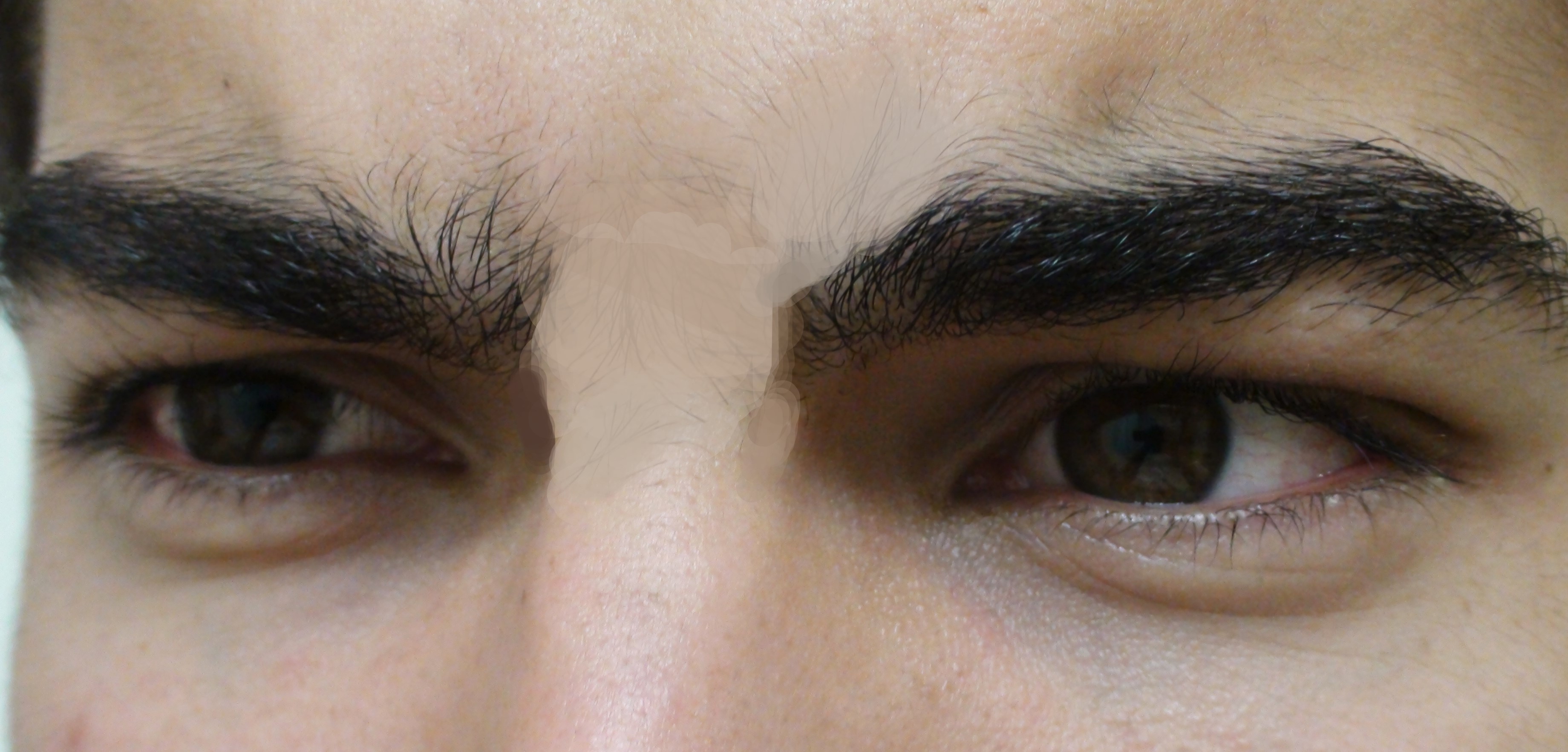 Unibrow Close Up 2