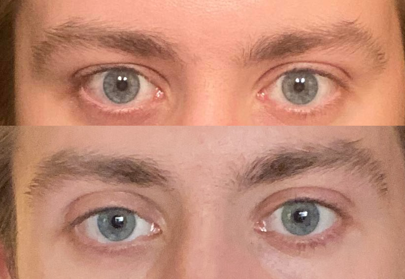 Eyes