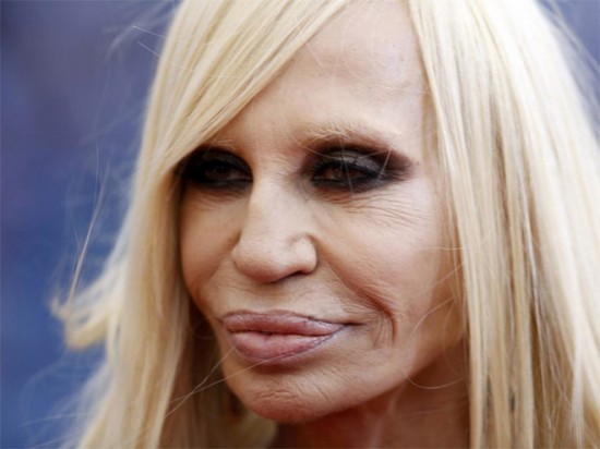 Plastic Surgery Gone Wrong 009 550x412