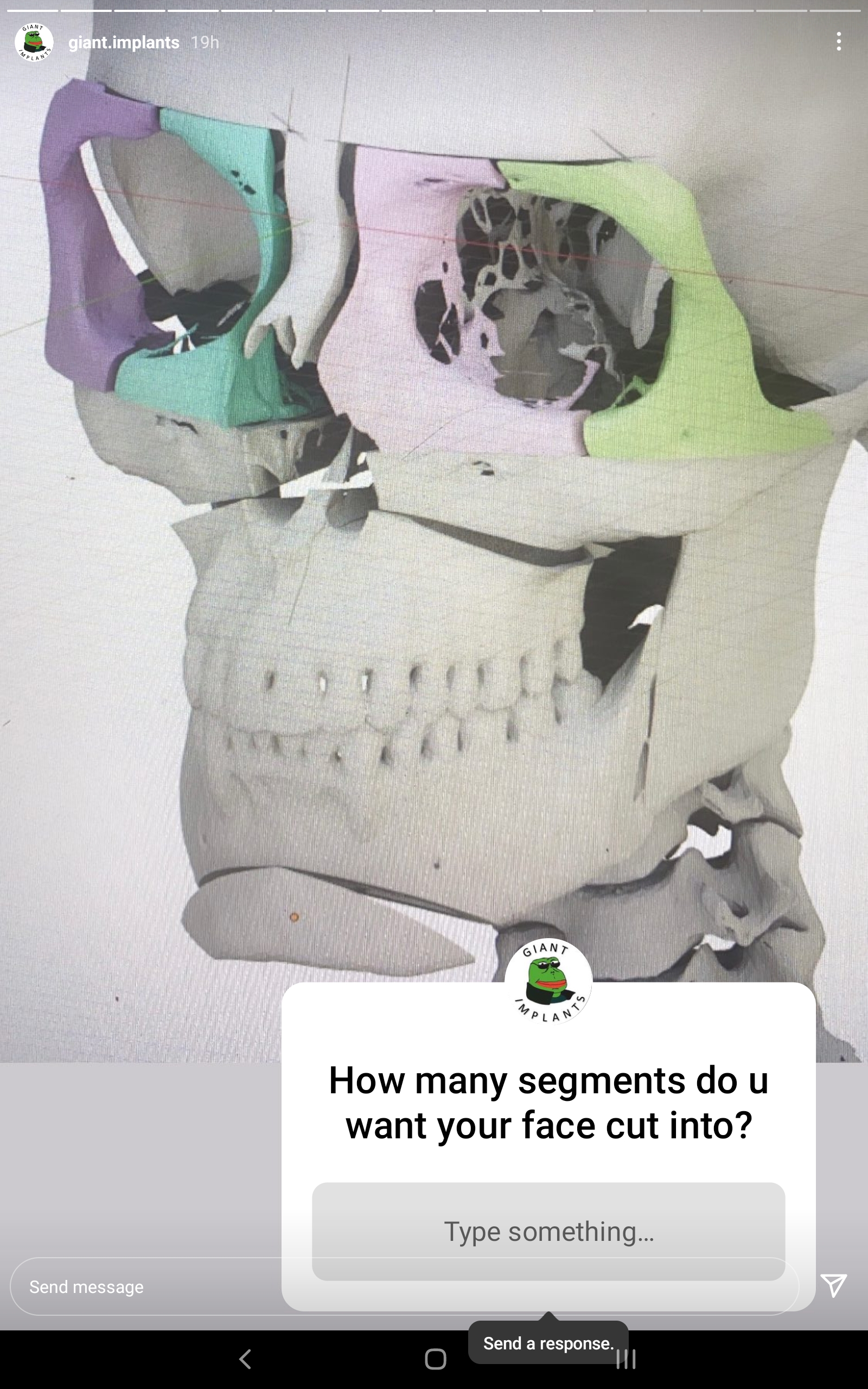 Screenshot 20211130 231241 Instagram Screenshot 20211130 231241 Instagram