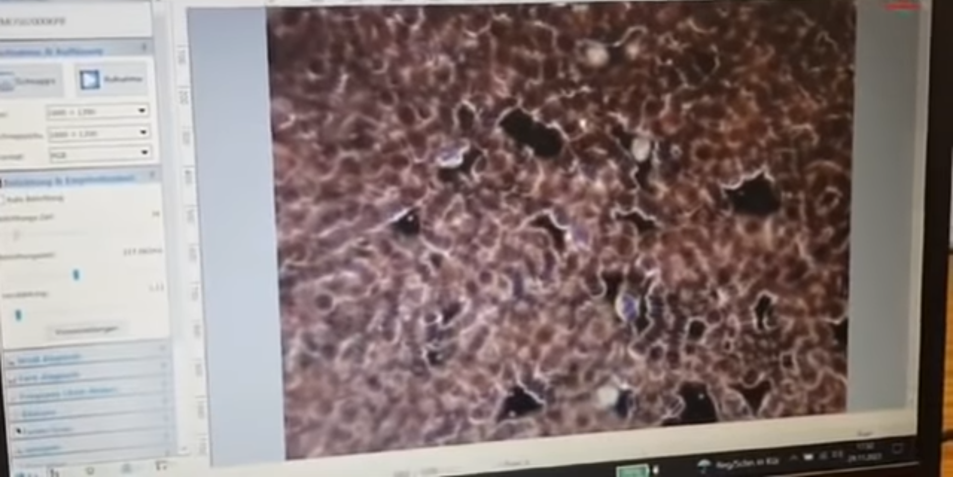 Vaxxed1
