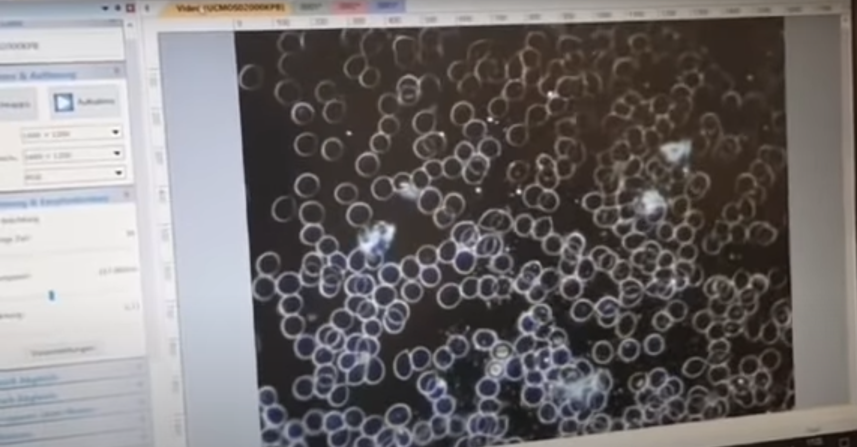 Unvaxxed1