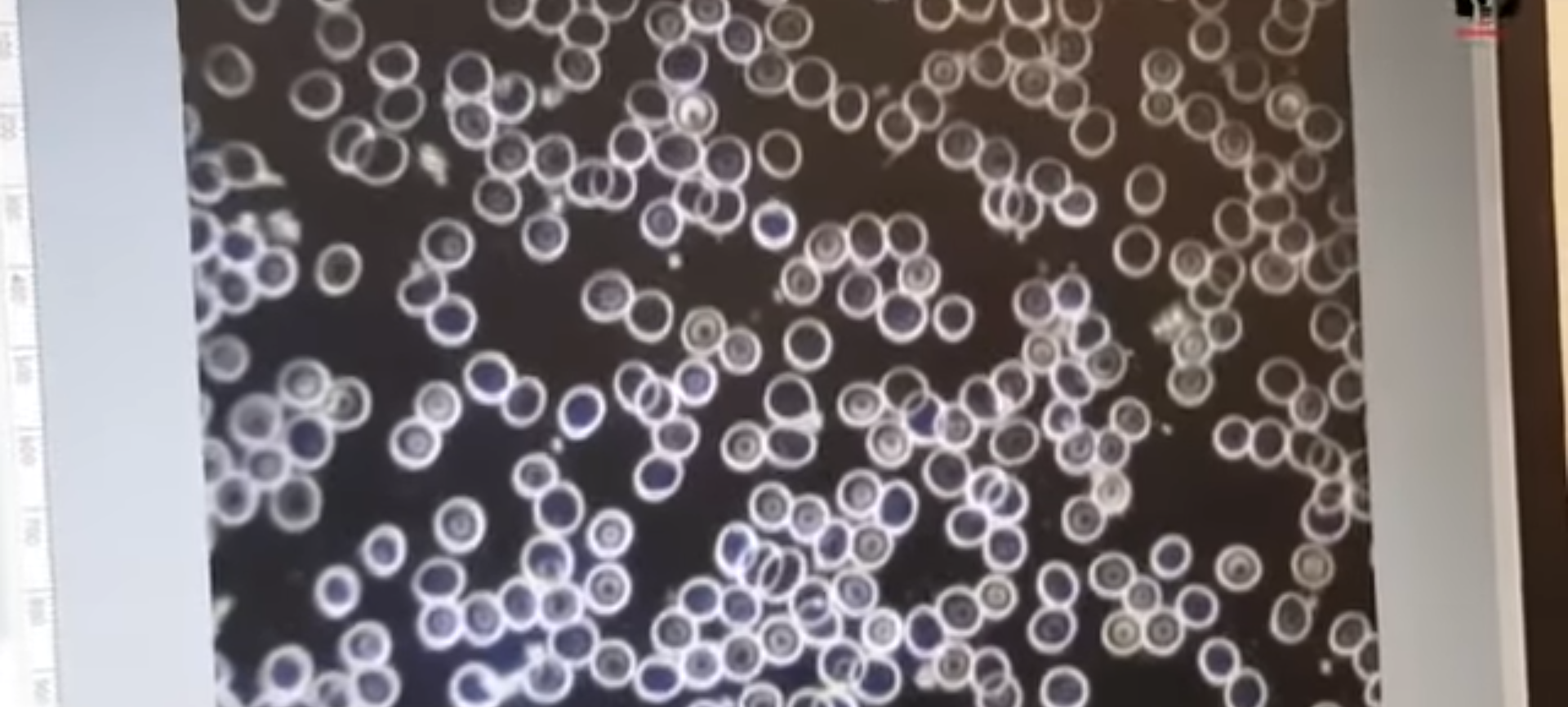 Unvaxxed2