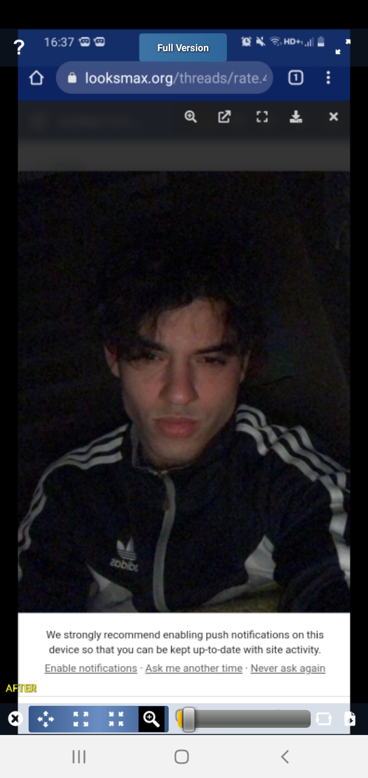Screenshot 20211205 163844 Plastic Surgery Simulator lite