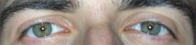 Ojos