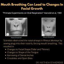 Dr. Matthew Standridge the Ketodontist - As a practicing dentist who also  performs orthodontics and airway management via oral appliance therapy I  can't help but see the cascade mouth breathing has on