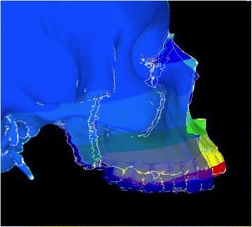 40510 2015 83 Fig16 HTML