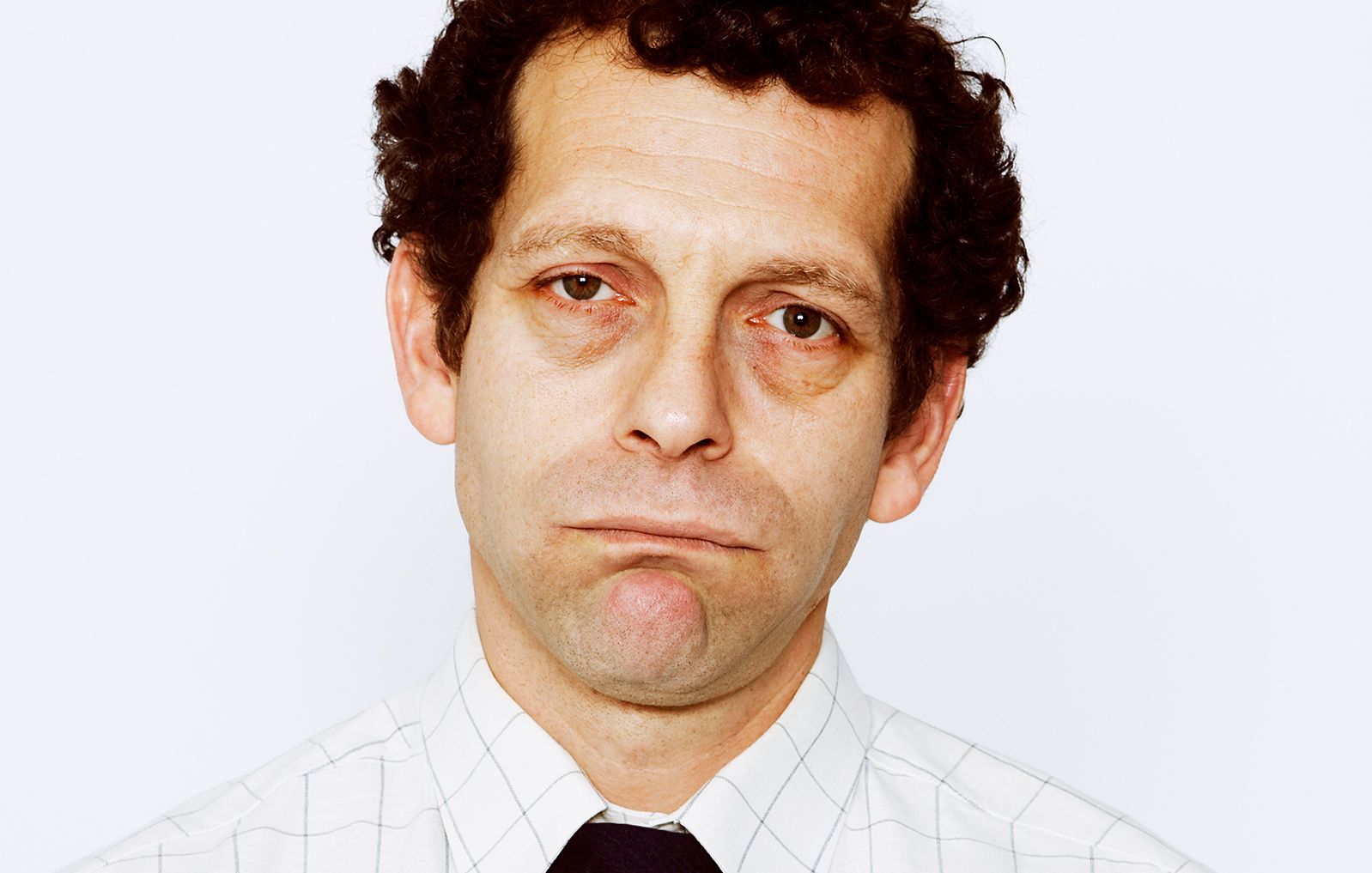 P 1 dark circles under the eyes 1519767176