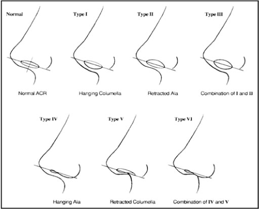 Columella anatomy Dr Roth