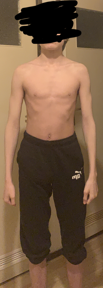 Bodytype