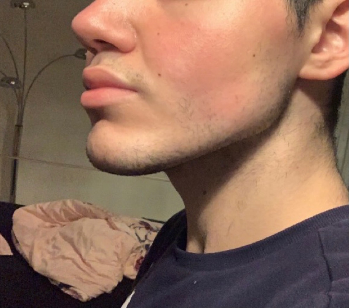 IMG 0898