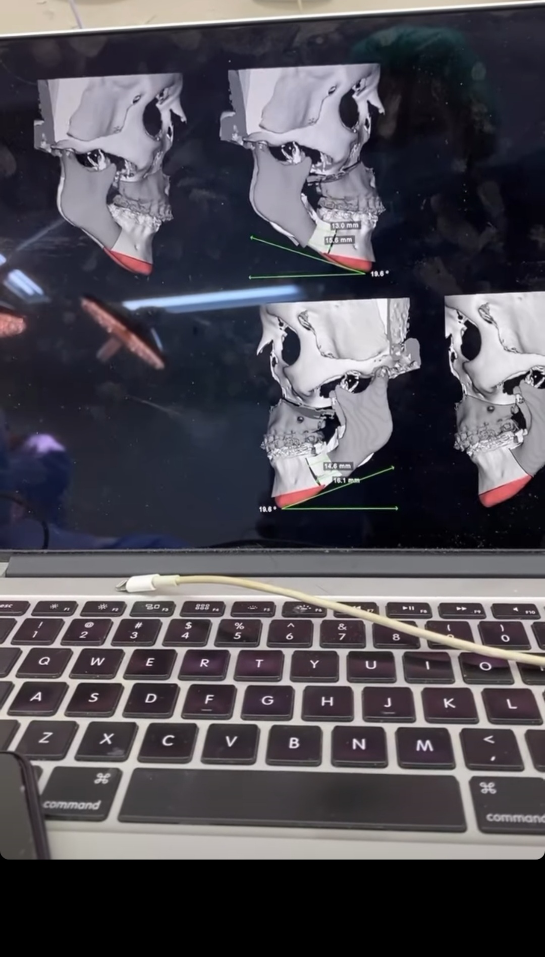 Screenshot 20211221 133156 Instagram